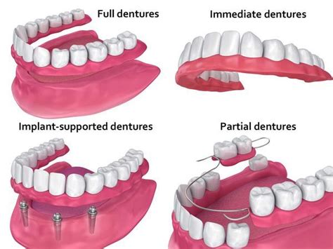 dentists near me for dentures.